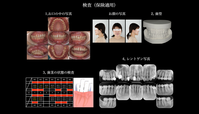 検査